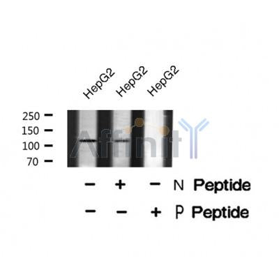 Western blot analysis of EPHB6 (Phospho-Tyr630) using HepG2 whole cell lysates