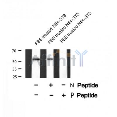 AF8435 staining Hela by IF/ICC. The sample were fixed with PFA and permeabilized in 0.1% Triton X-100,then blocked in 10% serum for 45 minutes at 25¡ãC. The primary antibody was diluted at 1/200 and incubated with the sample for 1 hour at 37¡ãC. An  Alexa Fluor 594 conjugated goat anti-rabbit IgG (H+L) Ab, diluted at 1/600, was used as the secondary antibod