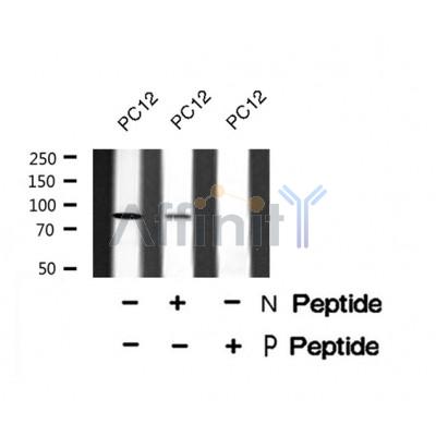 Western blot analysis FGFR2 (Phospho-Ser782) using PC12 whole cell lysates