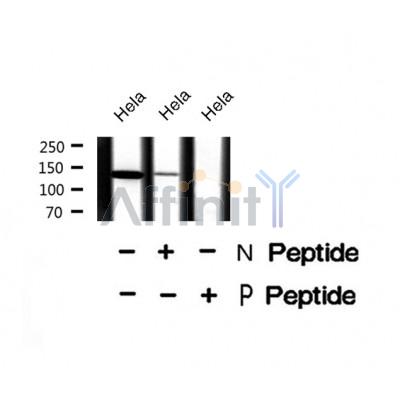 AF8461 staining HeLa by IF/ICC. The sample were fixed with PFA and permeabilized in 0.1% Triton X-100,then blocked in 10% serum for 45 minutes at 25¡ãC. The primary antibody was diluted at 1/200 and incubated with the sample for 1 hour at 37¡ãC. An  Alexa Fluor 594 conjugated goat anti-rabbit IgG (H+L) Ab, diluted at 1/600, was used as the secondary antibod
