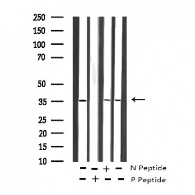 AF3274 staining COS7 by IF/ICC. The sample were fixed with PFA and permeabilized in 0.1% Triton X-100,then blocked in 10% serum for 45 minutes at 25¡ãC. The primary antibody was diluted at 1/200 and incubated with the sample for 1 hour at 37¡ãC. An  Alexa Fluor 594 conjugated goat anti-rabbit IgG (H+L) Ab, diluted at 1/600, was used as the secondary antibod