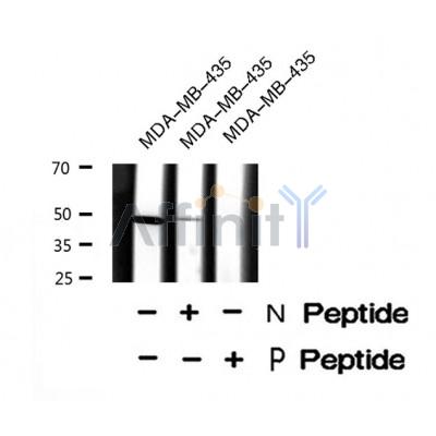 Western blot analysis of EIF5 (Phospho-Ser389+Ser390) using MDA-MB-435 whole cell lysates