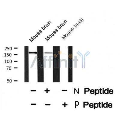 AF8476 staining HT29 by IF/ICC. The sample were fixed with PFA and permeabilized in 0.1% Triton X-100,then blocked in 10% serum for 45 minutes at 25¡ãC. The primary antibody was diluted at 1/200 and incubated with the sample for 1 hour at 37¡ãC. An  Alexa Fluor 594 conjugated goat anti-rabbit IgG (H+L) Ab, diluted at 1/600, was used as the secondary antibod