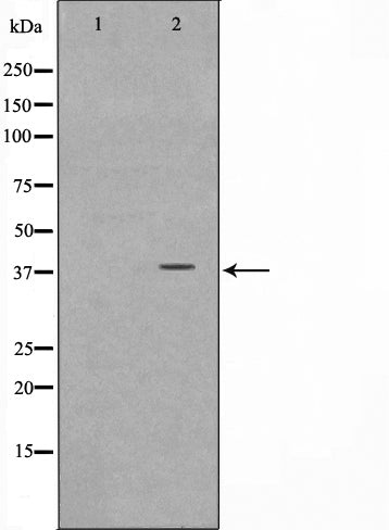Western blot analysis on Jurkat cell lysate using NT5C3 Antibody,The lane on the left is treated with the antigen-specific peptide.