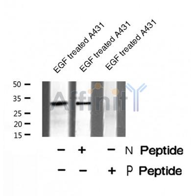 AF8496 staining Hela by IF/ICC. The sample were fixed with PFA and permeabilized in 0.1% Triton X-100,then blocked in 10% serum for 45 minutes at 25¡ãC. The primary antibody was diluted at 1/200 and incubated with the sample for 1 hour at 37¡ãC. An  Alexa Fluor 594 conjugated goat anti-rabbit IgG (H+L) Ab, diluted at 1/600, was used as the secondary antibod