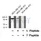 Western blot analysis of p73 (Phospho-Ser388) using MDA-MB-435 whole cell lysates