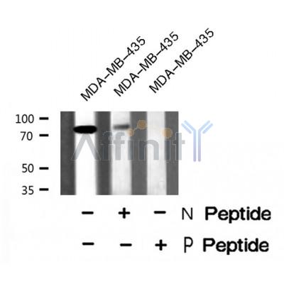 Western blot analysis of p73 (Phospho-Ser388) using MDA-MB-435 whole cell lysates