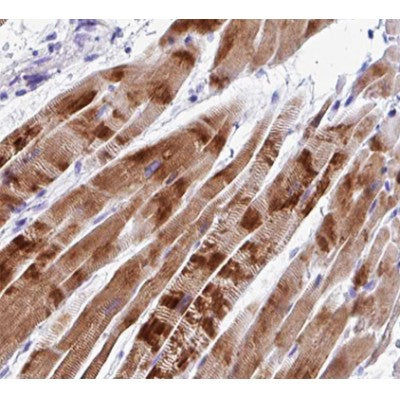 AF0475 at 1/100 staining human Skeletal muscle tissue sections by IHC-P. The tissue was formaldehyde fixed and a heat mediated antigen retrieval step in citrate buffer was performed. The tissue was then blocked and incubated with the antibody for 1.5 hours at 22¡ãC. An HRP conjugated goat anti-rabbit antibody was used as the secondary