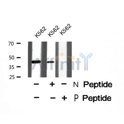Western blot analysis of Rad2/FEN1 (Phospho-Ser187) using K562 whole cell lysates