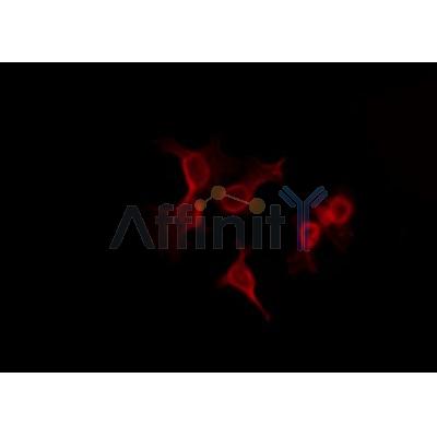 AF0418 staining LOVO by IF/ICC. The sample were fixed with PFA and permeabilized in 0.1% Triton X-100,then blocked in 10% serum for 45 minutes at 25¡ãC. The primary antibody was diluted at 1/200 and incubated with the sample for 1 hour at 37¡ãC. An  Alexa Fluor 594 conjugated goat anti-rabbit IgG (H+L) Ab, diluted at 1/600, was used as the secondary antibod