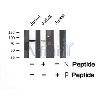 Western blot analysis SYN2 (Phospho-Ser425) using Jurkat whole cell lysates