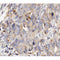 AF0465 at 1/100 staining human ovarian cancer tissue sections by IHC-P. The tissue was formaldehyde fixed and a heat mediated antigen retrieval step in citrate buffer was performed. The tissue was then blocked and incubated with the antibody for 1.5 hours at 22¡ãC. An HRP conjugated goat anti-rabbit antibody was used as the secondary