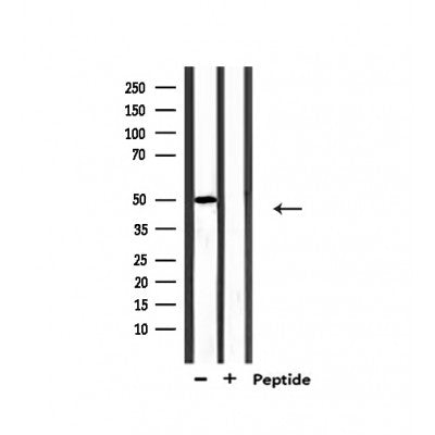 Western blot analysis of extracts from mouse brain, using MUC13 Antibody.