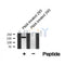 AF8524 staining Hela by IF/ICC. The sample were fixed with PFA and permeabilized in 0.1% Triton X-100,then blocked in 10% serum for 45 minutes at 25¡ãC. The primary antibody was diluted at 1/200 and incubated with the sample for 1 hour at 37¡ãC. An  Alexa Fluor 594 conjugated goat anti-rabbit IgG (H+L) Ab, diluted at 1/600, was used as the secondary antibod