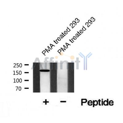AF8524 staining Hela by IF/ICC. The sample were fixed with PFA and permeabilized in 0.1% Triton X-100,then blocked in 10% serum for 45 minutes at 25¡ãC. The primary antibody was diluted at 1/200 and incubated with the sample for 1 hour at 37¡ãC. An  Alexa Fluor 594 conjugated goat anti-rabbit IgG (H+L) Ab, diluted at 1/600, was used as the secondary antibod