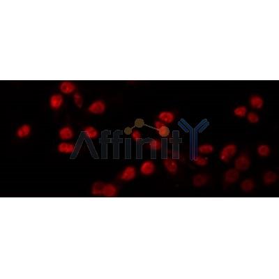 Western blot analysis of extracts from Mouse  liver, using PRDM12 Antibody. The lane on the left was treated with blocking peptide.