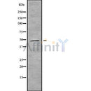 DF10033 at 1/100 staining Human lung tissue by IHC-P. The sample was formaldehyde fixed and a heat mediated antigen retrieval step in citrate buffer was performed. The sample was then blocked and incubated with the antibody for 1.5 hours at 22¡ãC. An HRP conjugated goat anti-rabbit antibody was used as the secondary