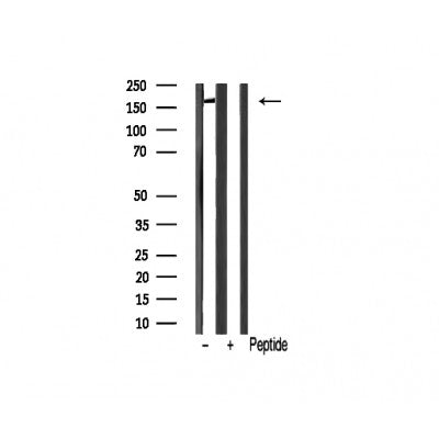 AF0564 staining HepG2 cells by IF/ICC. The sample were fixed with PFA and permeabilized in 0.1% Triton X-100,then blocked in 10% serum for 45 minutes at 25¡ãC. The primary antibody was diluted at 1/200 and incubated with the sample for 1 hour at 37¡ãC. An  Alexa Fluor 594 conjugated goat anti-rabbit IgG (H+L) antibody(Cat.# S0006), diluted at 1/600, was used as secondary antibod