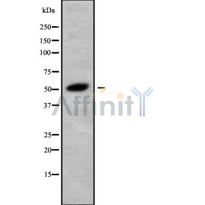 DF10055 at 1/100 staining Human breast cancer tissue by IHC-P. The sample was formaldehyde fixed and a heat mediated antigen retrieval step in citrate buffer was performed. The sample was then blocked and incubated with the antibody for 1.5 hours at 22¡ãC. An HRP conjugated goat anti-rabbit antibody was used as the secondary