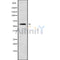 DF10056 staining HuvEc by IF/ICC. The sample were fixed with PFA and permeabilized in 0.1% Triton X-100,then blocked in 10% serum for 45 minutes at 25¡ãC. The primary antibody was diluted at 1/200 and incubated with the sample for 1 hour at 37¡ãC. An  Alexa Fluor 594 conjugated goat anti-rabbit IgG (H+L) Ab, diluted at 1/600, was used as the secondary antibod