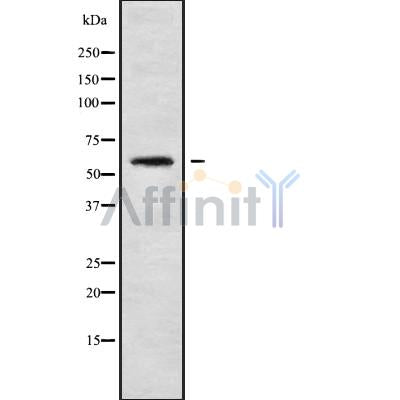 DF10056 staining HuvEc by IF/ICC. The sample were fixed with PFA and permeabilized in 0.1% Triton X-100,then blocked in 10% serum for 45 minutes at 25¡ãC. The primary antibody was diluted at 1/200 and incubated with the sample for 1 hour at 37¡ãC. An  Alexa Fluor 594 conjugated goat anti-rabbit IgG (H+L) Ab, diluted at 1/600, was used as the secondary antibod
