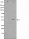 Western blot analysis on K562 cell lysate using ARMX3 Antibody,The lane on the left is treated with the antigen-specific peptide.