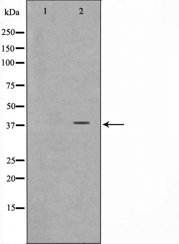 Western blot analysis on K562 cell lysate using ARMX3 Antibody,The lane on the left is treated with the antigen-specific peptide.