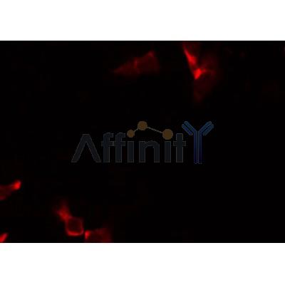 AF0514 staining Hela by IF/ICC. The sample were fixed with PFA and permeabilized in 0.1% Triton X-100,then blocked in 10% serum for 45 minutes at 25¡ãC. The primary antibody was diluted at 1/200 and incubated with the sample for 1 hour at 37¡ãC. An  Alexa Fluor 594 conjugated goat anti-rabbit IgG (H+L) Ab, diluted at 1/600, was used as the secondary antibod