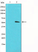 Western blot analysis on LOVO cell lysate using GLUT3 Antibody,The lane on the left is treated with the antigen-specific peptide.