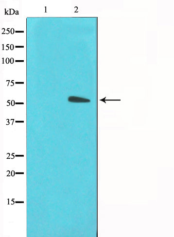 Western blot analysis on LOVO cell lysate using GLUT3 Antibody,The lane on the left is treated with the antigen-specific peptide.