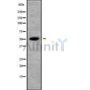 DF10060 staining HepG2 by IF/ICC. The sample were fixed with PFA and permeabilized in 0.1% Triton X-100,then blocked in 10% serum for 45 minutes at 25¡ãC. The primary antibody was diluted at 1/200 and incubated with the sample for 1 hour at 37¡ãC. An  Alexa Fluor 594 conjugated goat anti-rabbit IgG (H+L) Ab, diluted at 1/600, was used as the secondary antibod
