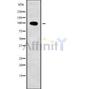 DF10061 at 1/100 staining Human spleen tissue by IHC-P. The sample was formaldehyde fixed and a heat mediated antigen retrieval step in citrate buffer was performed. The sample was then blocked and incubated with the antibody for 1.5 hours at 22¡ãC. An HRP conjugated goat anti-rabbit antibody was used as the secondary