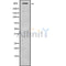 DF10064 at 1/100 staining human brain tissue sections by IHC-P. The tissue was formaldehyde fixed and a heat mediated antigen retrieval step in citrate buffer was performed. The tissue was then blocked and incubated with the antibody for 1.5 hours at 22¡ãC. An HRP conjugated goat anti-rabbit antibody was used as the secondary