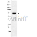 Western blot analysis of C16orf44 using HUVEC whole cell lysates
