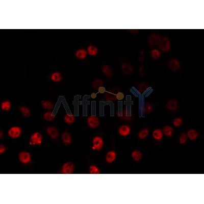AF0511 staining HeLa by IF/ICC. The sample were fixed with PFA and permeabilized in 0.1% Triton X-100,then blocked in 10% serum for 45 minutes at 25¡ãC. The primary antibody was diluted at 1/200 and incubated with the sample for 1 hour at 37¡ãC. An  Alexa Fluor 594 conjugated goat anti-rabbit IgG (H+L) Ab, diluted at 1/600, was used as the secondary antibod