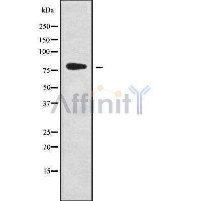 Western blot analysis of ZNF441 using COLO205 whole cell lysates