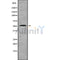 DF10071 at 1/100 staining Mouse kidney tissue by IHC-P. The sample was formaldehyde fixed and a heat mediated antigen retrieval step in citrate buffer was performed. The sample was then blocked and incubated with the antibody for 1.5 hours at 22¡ãC. An HRP conjugated goat anti-rabbit antibody was used as the secondary