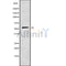 DF10072 at 1/100 staining Human prostate tissue by IHC-P. The sample was formaldehyde fixed and a heat mediated antigen retrieval step in citrate buffer was performed. The sample was then blocked and incubated with the antibody for 1.5 hours at 22¡ãC. An HRP conjugated goat anti-rabbit antibody was used as the secondary