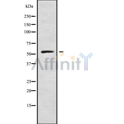 DF10072 at 1/100 staining Human prostate tissue by IHC-P. The sample was formaldehyde fixed and a heat mediated antigen retrieval step in citrate buffer was performed. The sample was then blocked and incubated with the antibody for 1.5 hours at 22¡ãC. An HRP conjugated goat anti-rabbit antibody was used as the secondary