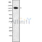 Western blot analysis of CIC using HUVEC whole cell lysates