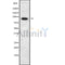 DF10075 at 1/100 staining Rat lung tissue by IHC-P. The sample was formaldehyde fixed and a heat mediated antigen retrieval step in citrate buffer was performed. The sample was then blocked and incubated with the antibody for 1.5 hours at 22¡ãC. An HRP conjugated goat anti-rabbit antibody was used as the secondary