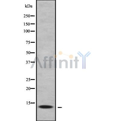 DF10076 at 1/100 staining Mouse pancreas tissue by IHC-P. The sample was formaldehyde fixed and a heat mediated antigen retrieval step in citrate buffer was performed. The sample was then blocked and incubated with the antibody for 1.5 hours at 22¡ãC. An HRP conjugated goat anti-rabbit antibody was used as the secondary