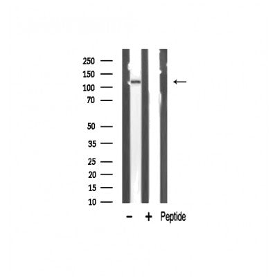 Western blot analysis of PKCB1 expression in Mouse brain lysate