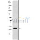 Western blot analysis of extracts from mouse muscle, using NOLA1 Antibody.