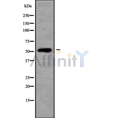 DF10082 at 1/100 staining Human liver tissue by IHC-P. The sample was formaldehyde fixed and a heat mediated antigen retrieval step in citrate buffer was performed. The sample was then blocked and incubated with the antibody for 1.5 hours at 22¡ãC. An HRP conjugated goat anti-rabbit antibody was used as the secondary
