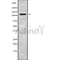 Western blot analysis of VPS54 using HepG2 whole cell lysates
