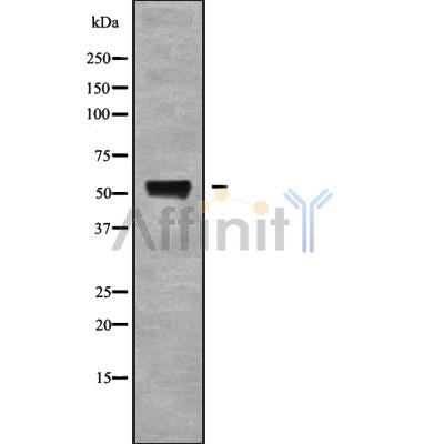 Western blot analysis of RHCG using 293 whole cell lysates