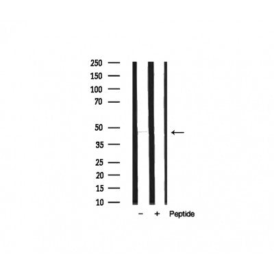 AF0779 at 1/100 staining human Brain tissue sections by IHC-P. The tissue was formaldehyde fixed and a heat mediated antigen retrieval step in citrate buffer was performed. The tissue was then blocked and incubated with the antibody for 1.5 hours at 22¡ãC. An HRP conjugated goat anti-rabbit antibody was used as the secondary