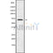 Western blot analysis of CDYL1 using HUVEC whole cell lysates