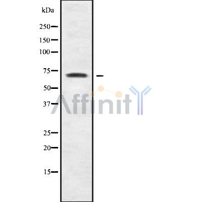 Western blot analysis of CDYL1 using HUVEC whole cell lysates